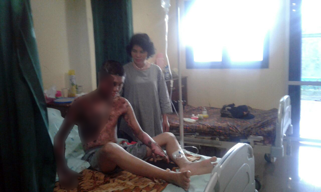 Ervinda Rizki Pratama (19) warga Pringsewu yang dibakar menggunakan pertalite dalam perawatan. (Lampungnews/Adam)
